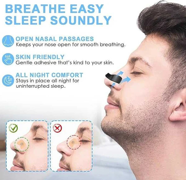 Sleepco Nasal Dilator Starter Kit. 4 Sizes. Improve airflow