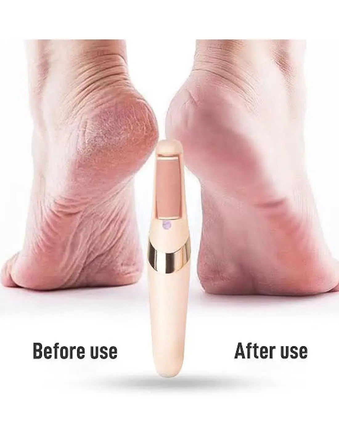 Rechargeable Electric Foot File Callus Remover for Wet & Dry Pedicure